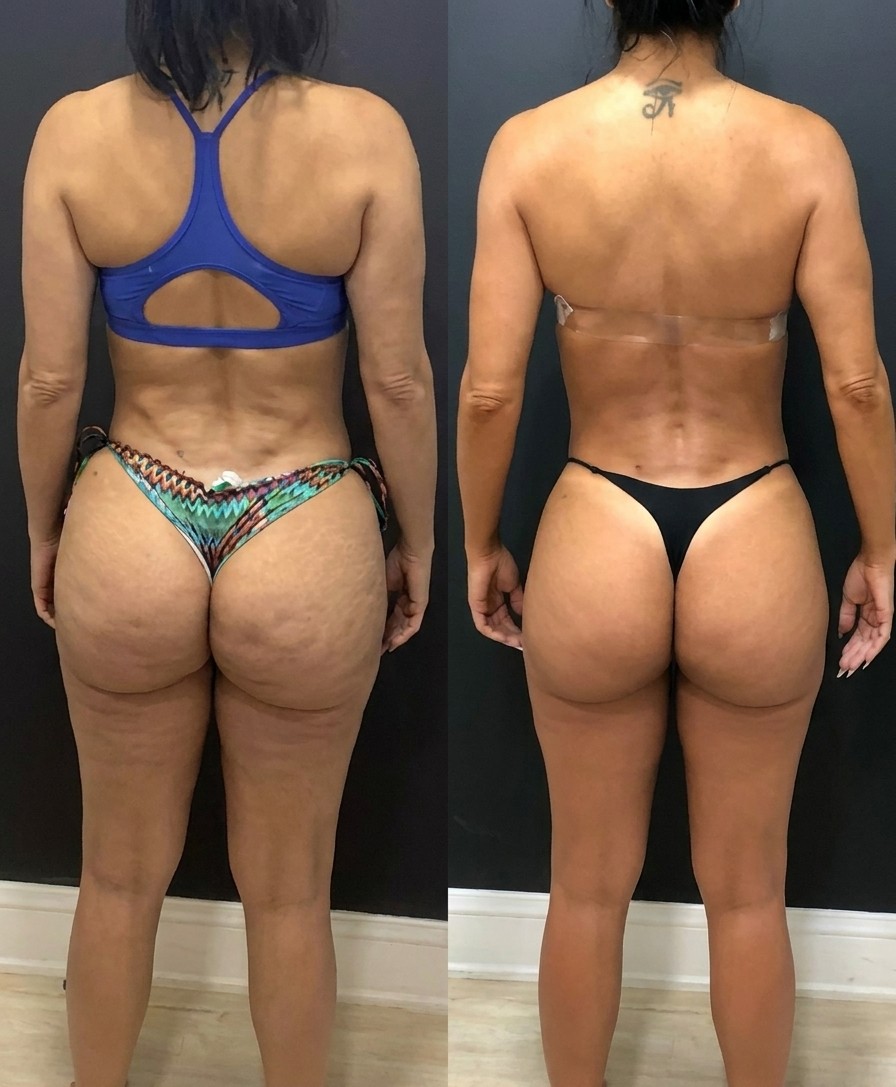 Doce Desinflamação