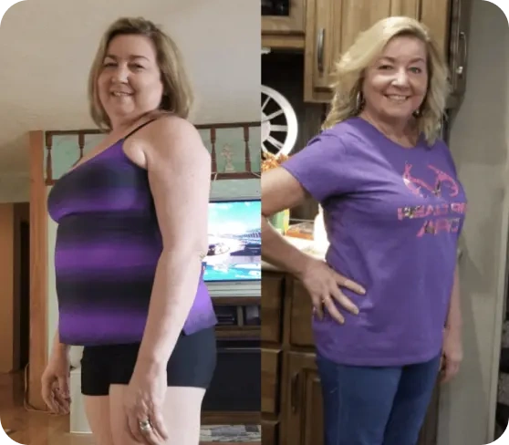 Antes e Depois Prova 4